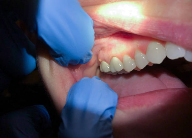 Best Pediatric Emergency Dentist in Channahon, IL